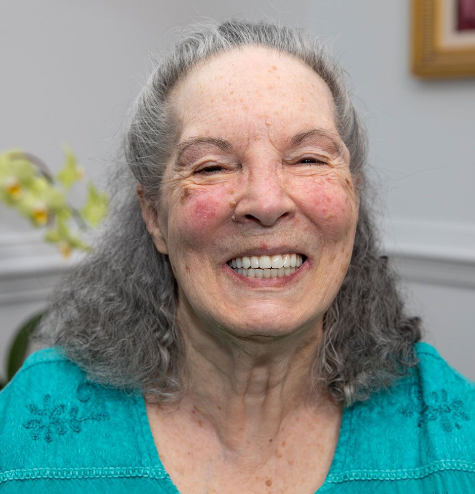 gloria with new smile after all on 4 dr tebyanian