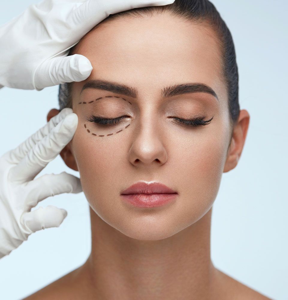 lady with rejuvenated face after surgery